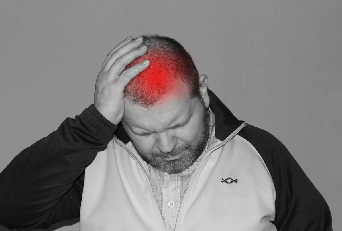 migraine